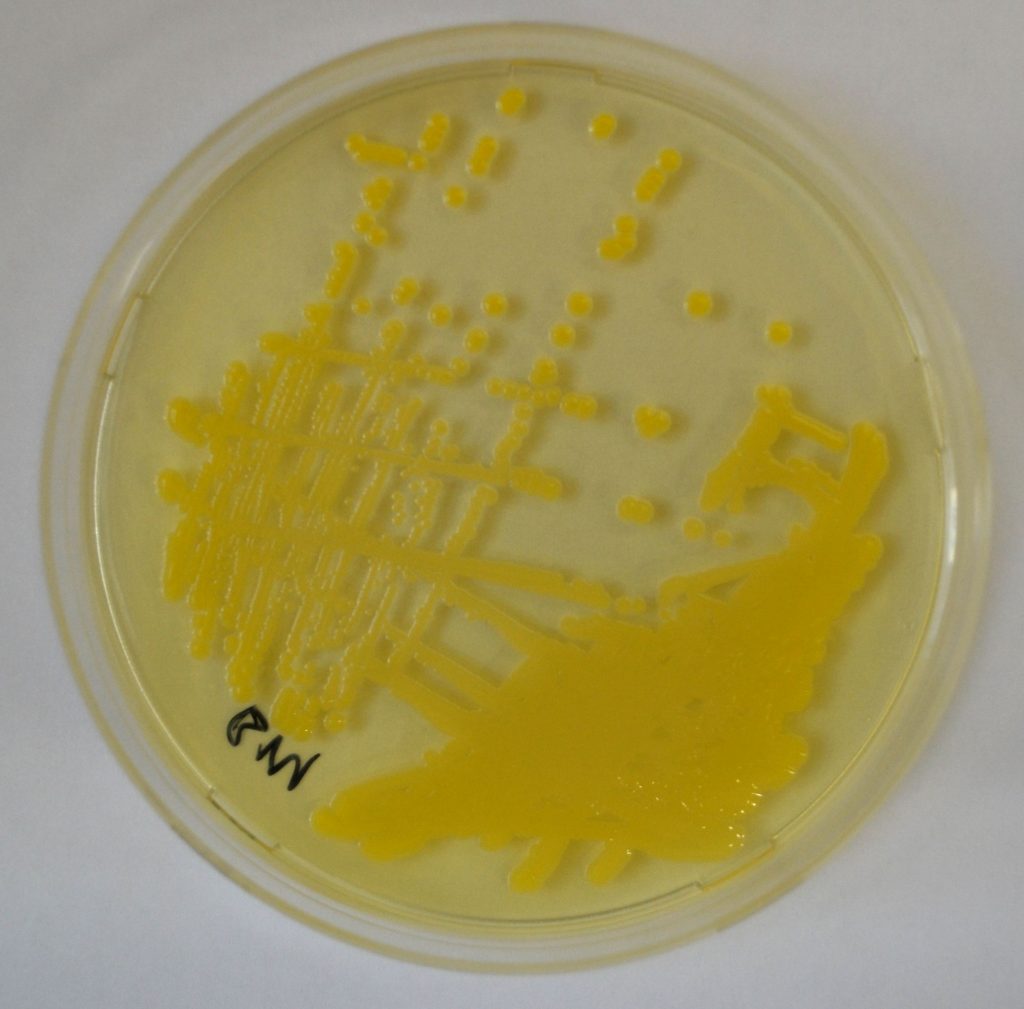 Indemnisation des conséquences d'un staphylocoque doré