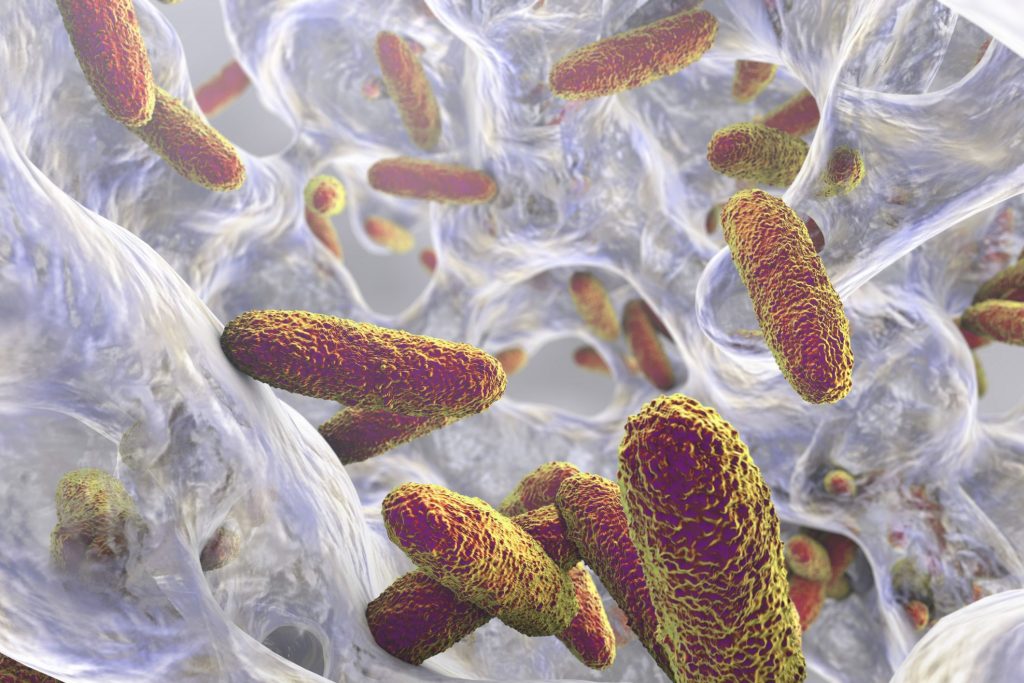 Indemnisation suite à un décès à cause d'une infection nosocomiale